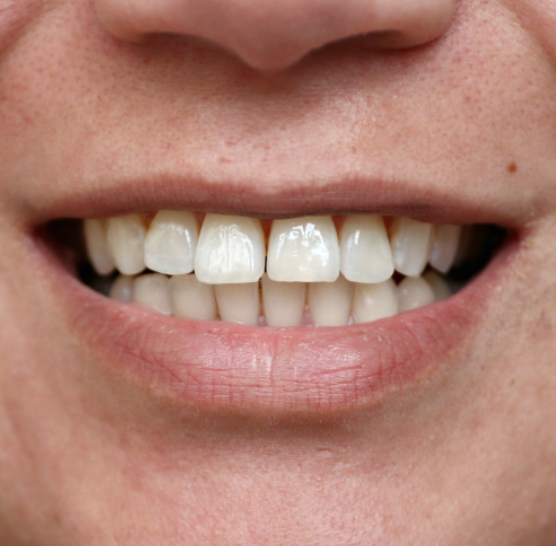 Scherm­afbeelding 2025-07-14 om 10.05.03