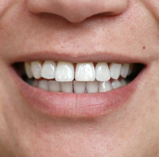 Scherm­afbeelding 2025-07-14 om 10.05.11